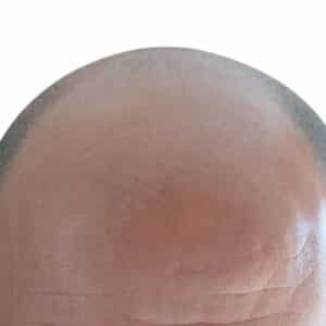 Consultation et devis