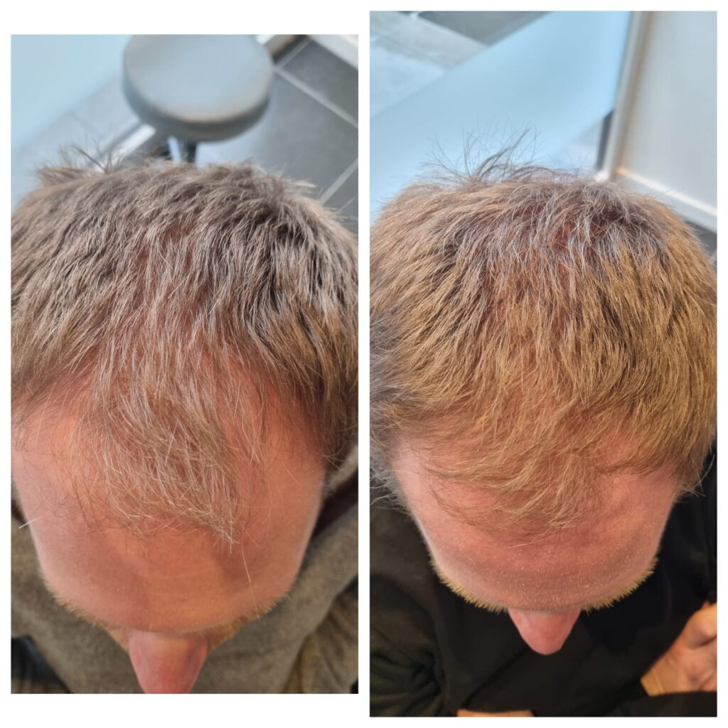 Reconstruction Capillaire - RegenX - Image Avant/Après - Esthetic For You à Theux